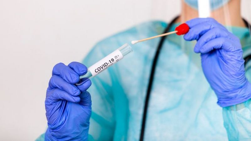 Read more about the article Sorumluluk Alanımızdaki Tüm Çalışanlara Covid-19 PCR Testi